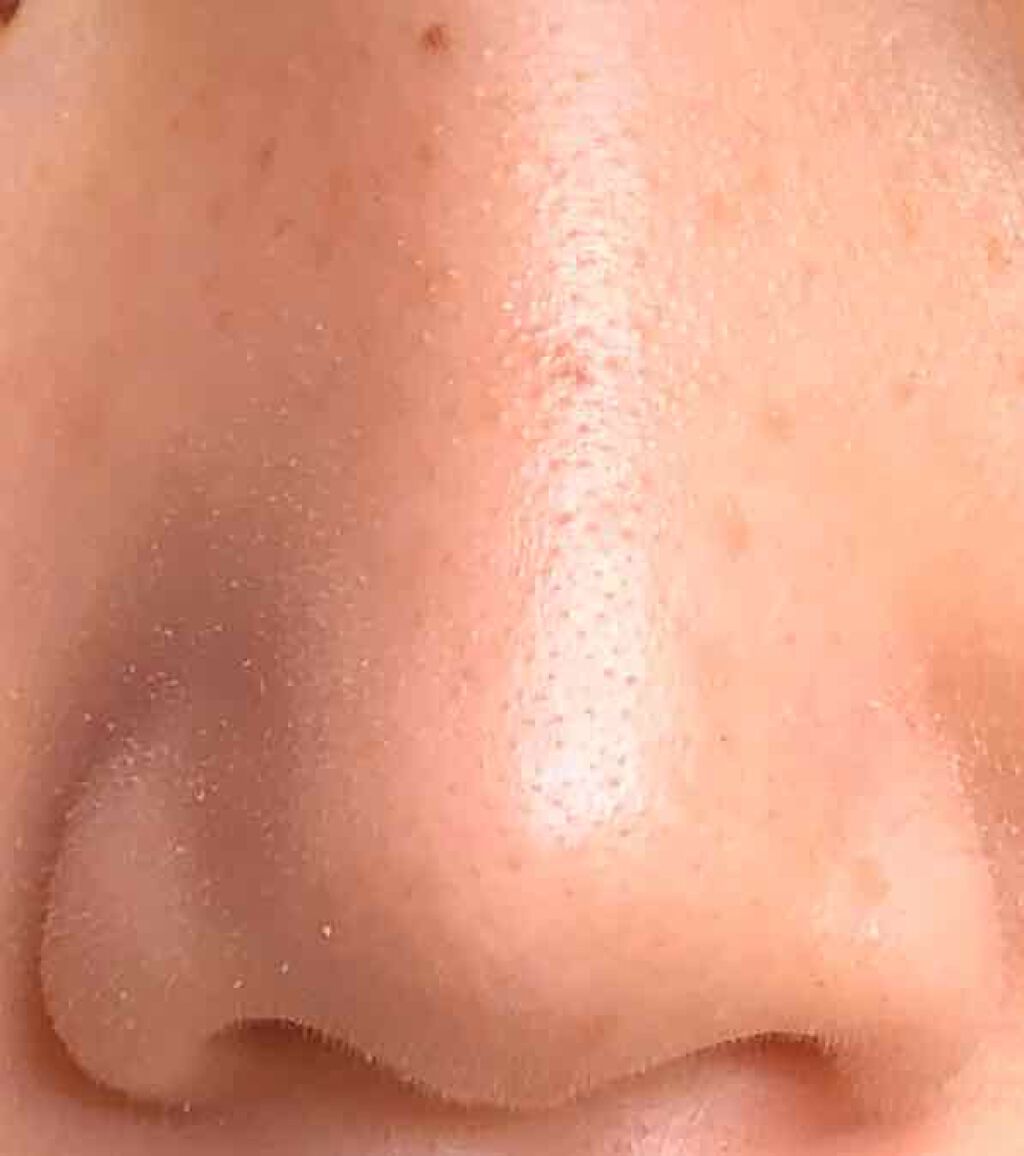 DETクリア ブライト＆ピール ピーリングジェリー <ミックスベリーの香り>/Detclear/ピーリングを使ったクチコミ（2枚目）