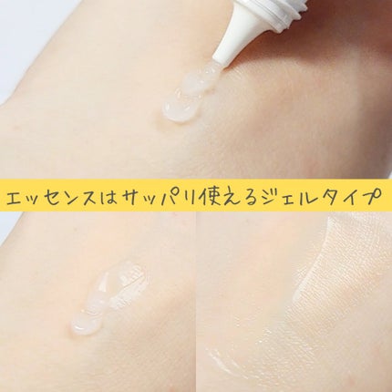 チョコブラ スペシャル毛穴ケアセット/Chocobra/スキンケアキットを使ったクチコミ(4枚目)