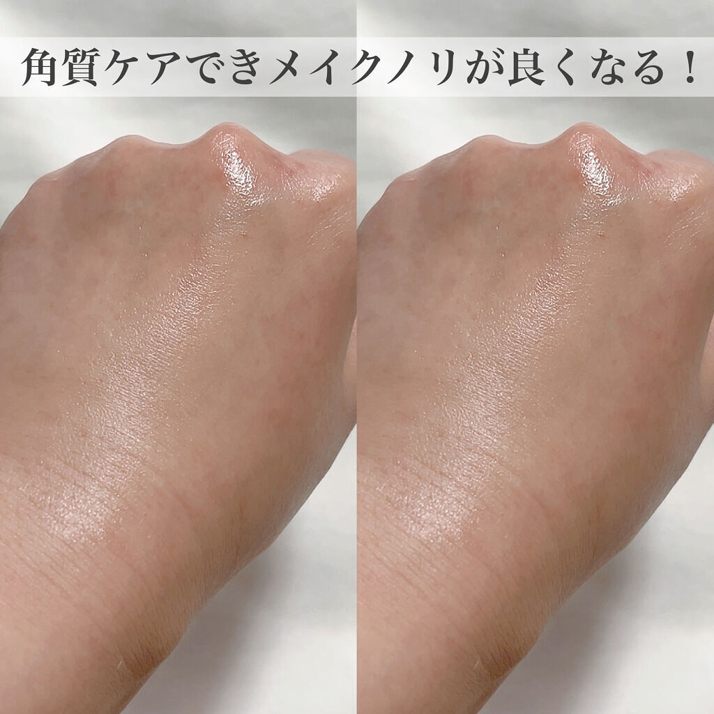 スーパーシカパッド/MEDICUBE/トナーパッドを使ったクチコミ（3枚目）