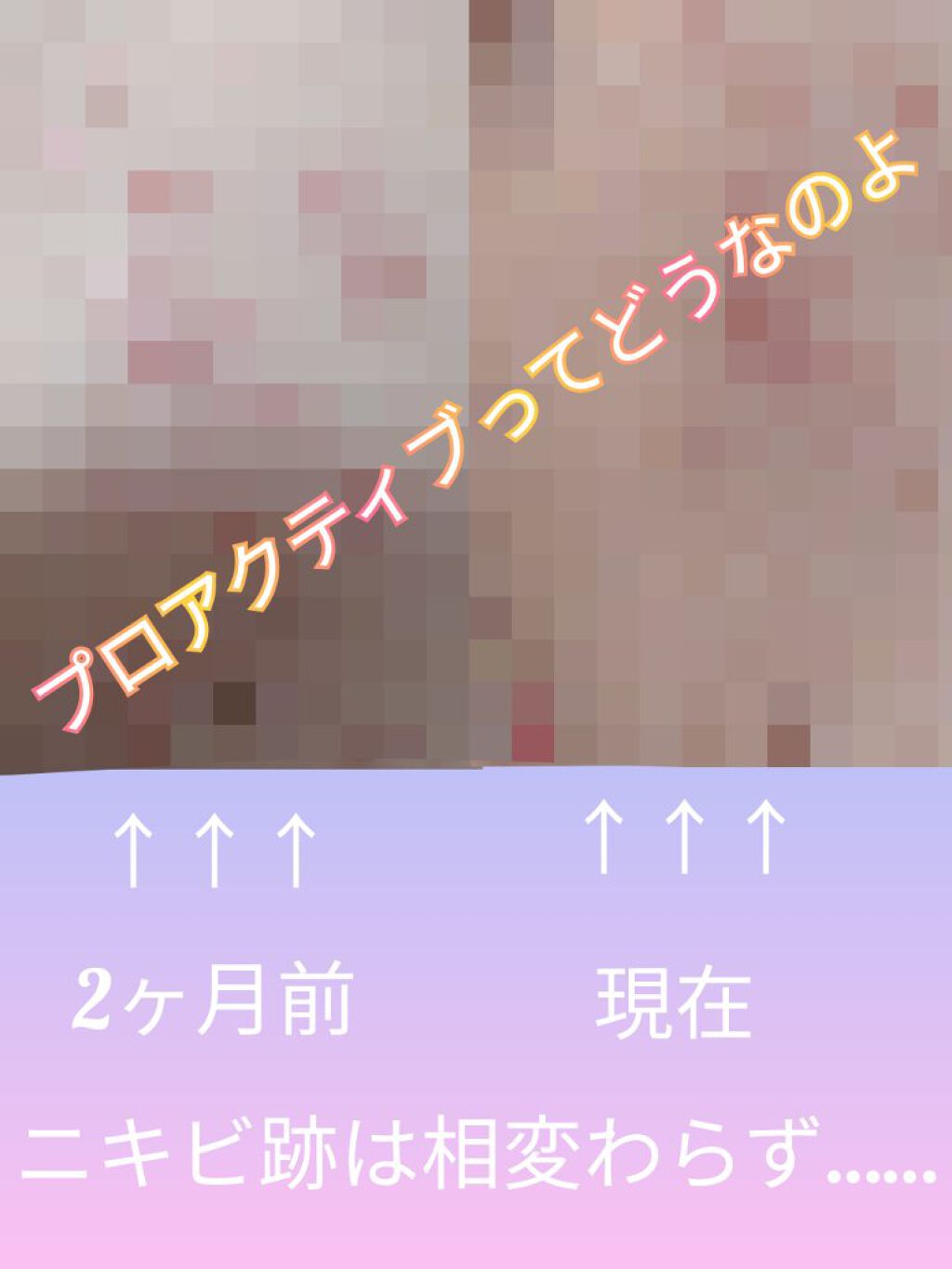 薬用3ステップセット30日サイズ/プロアクティブ/トライアルキットを使ったクチコミ（1枚目）