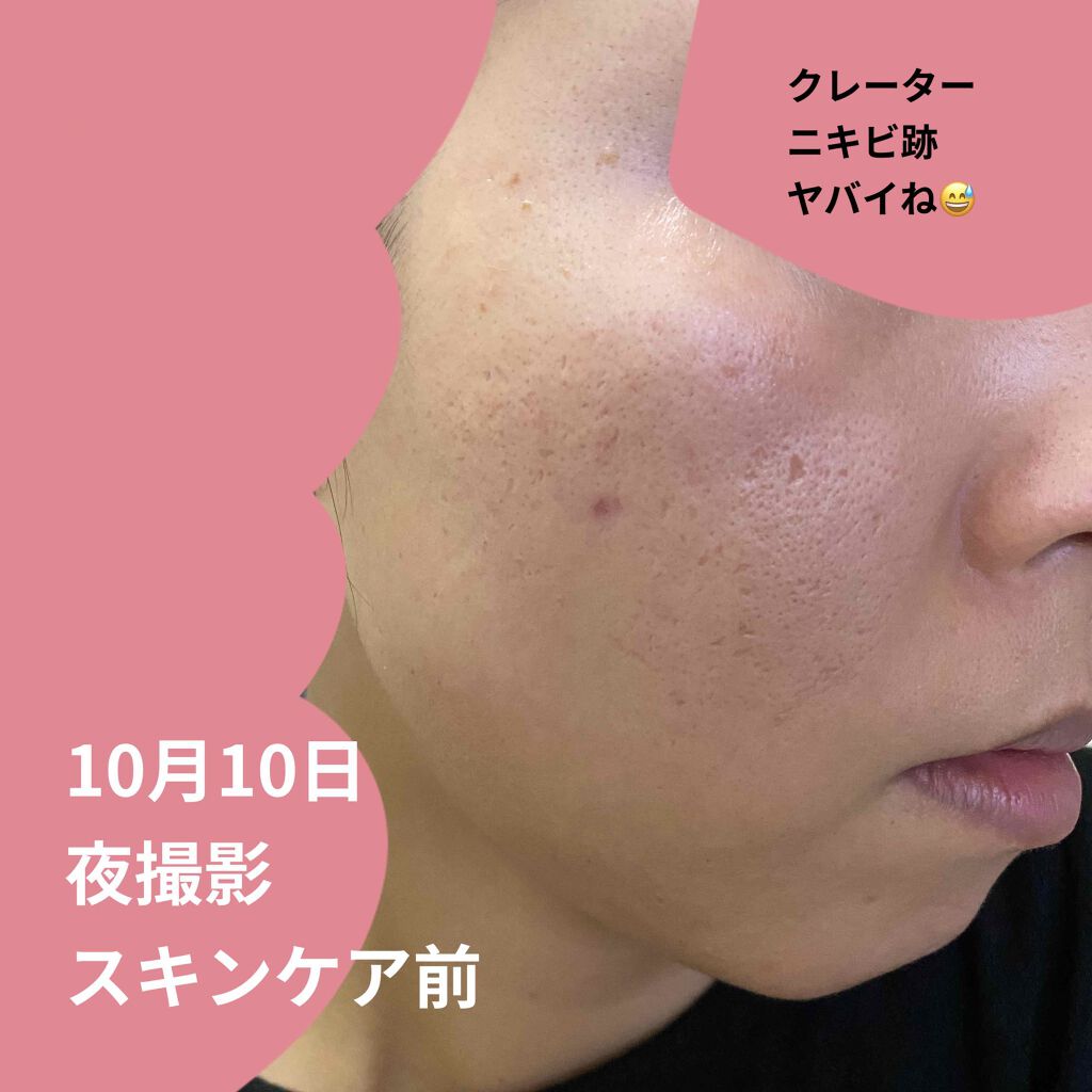 ゼオスキン ZO SKIN バランサートナー ミラミン ミラミックス - www