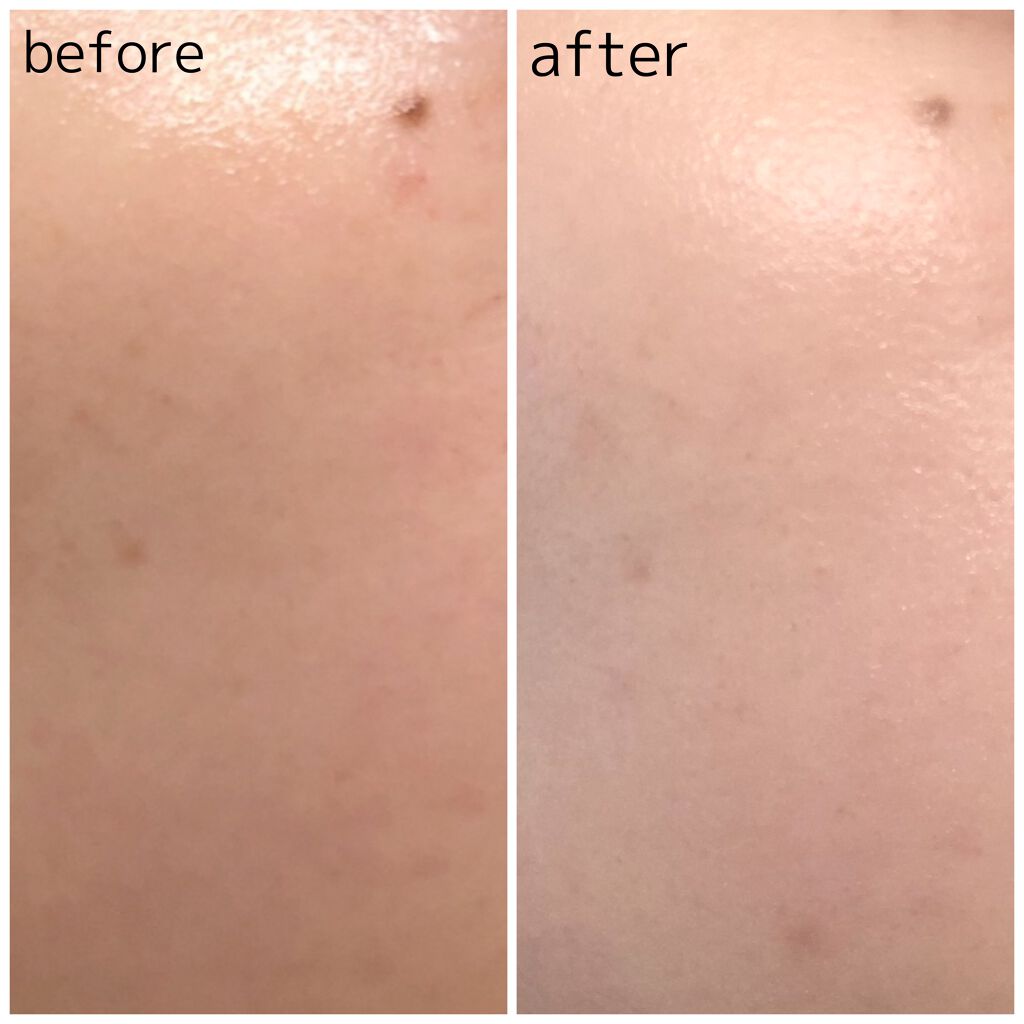 メラノショット ホワイト D/ONE BY KOSE/美容液を使ったクチコミ(4枚目)