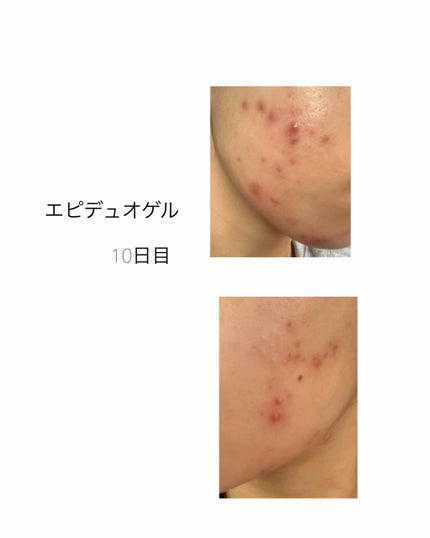 ãšããã¥ãªã²ã«/ãã«ãæ ªåŒäŒç€Ÿ/ãã®ä»ã䜿ã£ãã¯ãã³ãïŒ1æç®ïŒ