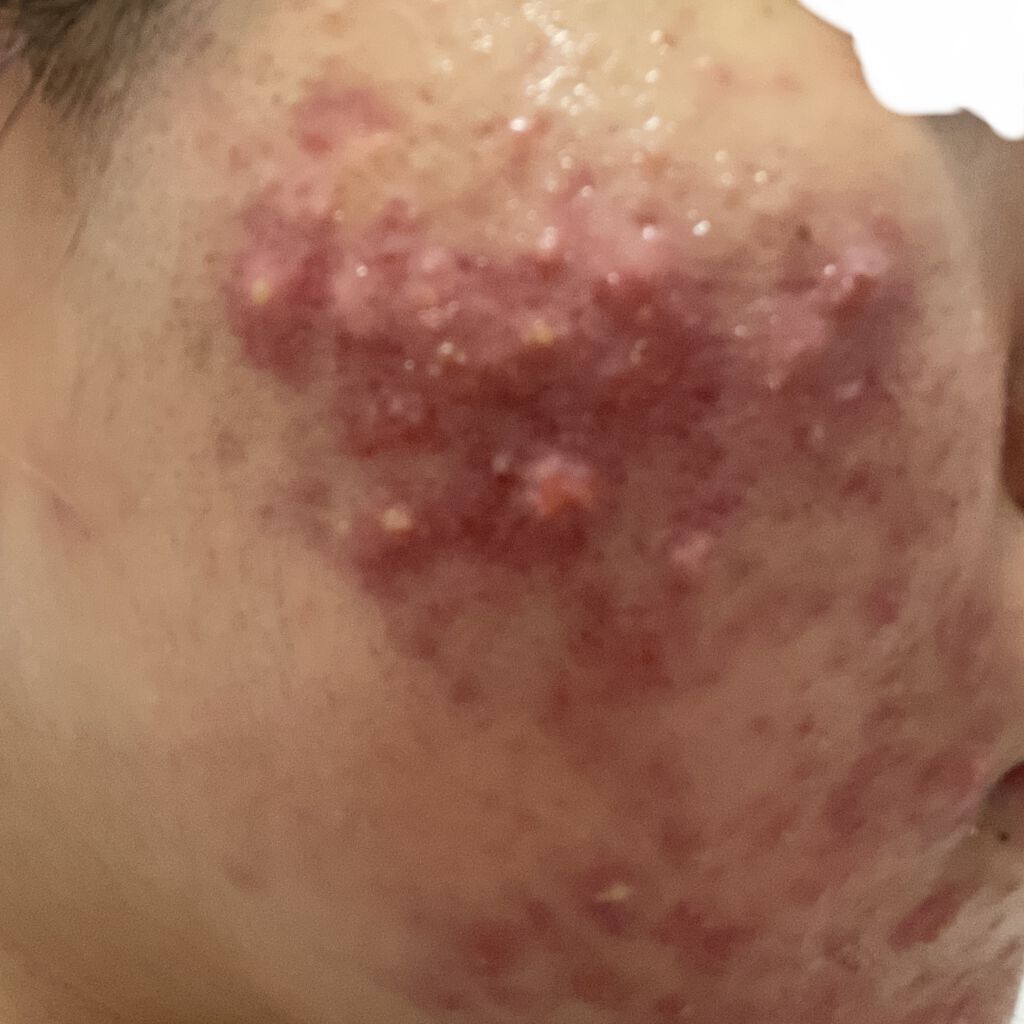 ゴールデンホホバオイル/SAKURA&NATURAL/ボディオイルを使ったクチコミ（2枚目）