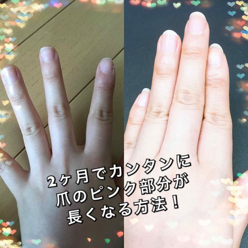 ディープセラム Dr Nailを使った口コミ 超簡単 2ヶ月で爪をきれいにのばしてハイ By ちょこきゃら 敏感肌 代後半 Lips