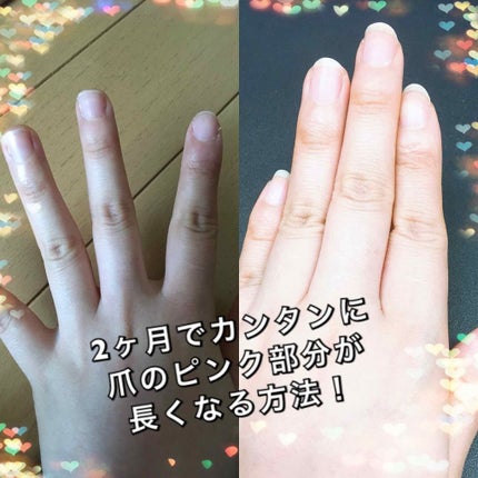 ディープセラム/Dr.Nail/ネイルオイル・トリートメントを使ったクチコミ(1枚目)