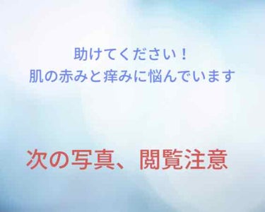 みゆ on LIPS 「初投稿です。昔から肌の赤みがあったのですが、最近、悪化しました..」（1枚目）