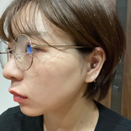 しに子ちゃん on LIPS 「みんな元気!?わたしは陰鬱!ストレス性の頭痛と過食衝動と消化不..」(2枚目)