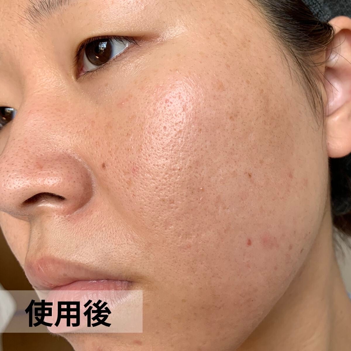 オバジC リファインローション /オバジ/化粧水を使ったクチコミ(7枚目)