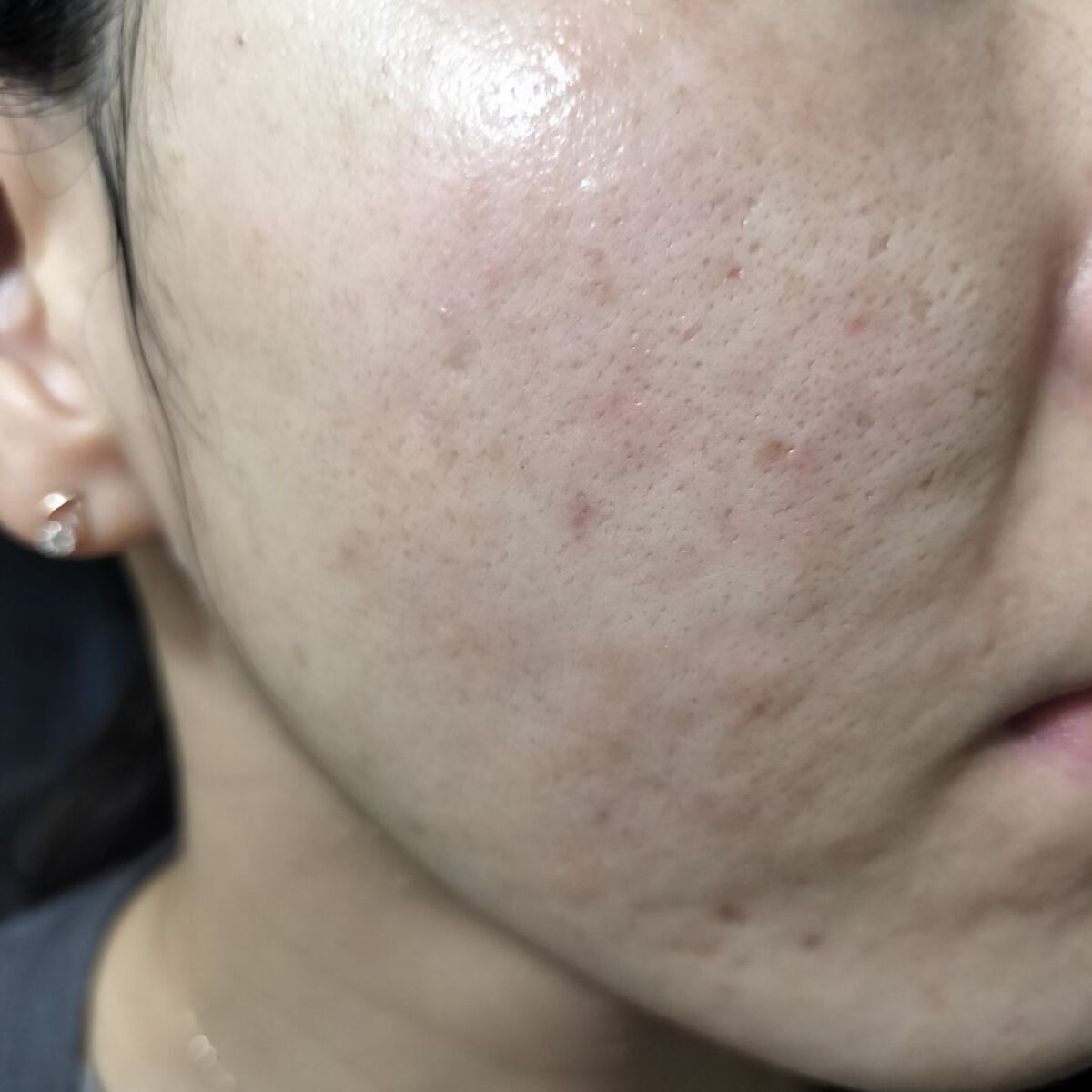 ワセリンHG チューブ (化粧用油)/大洋製薬/ボディクリームを使ったクチコミ（1枚目）