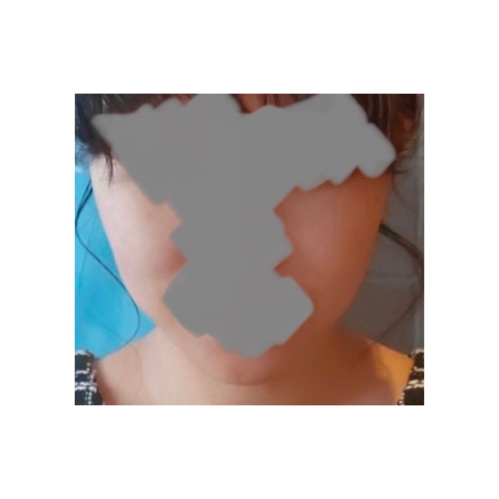 白潤プレミアム 薬用浸透美白化粧水しっとり/肌ラボ/化粧水を使ったクチコミ（3枚目）