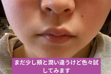 N.M.F アクアリング エフェクト クリーム/MEDIHEAL/フェイスクリームを使ったクチコミ(3枚目)