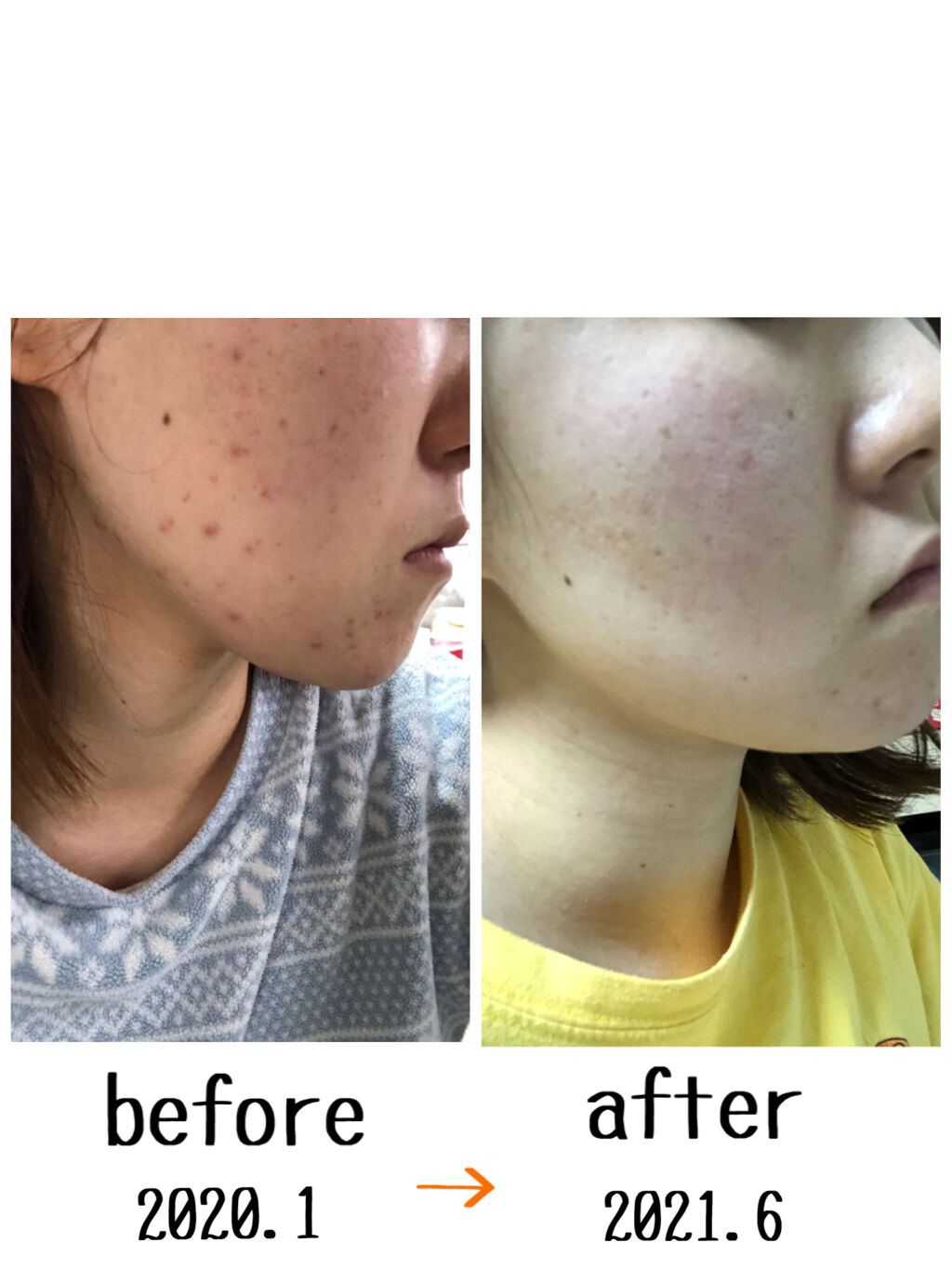 アルビオン 薬用スキンコンディショナー エッセンシャル/ALBION/化粧水を使ったクチコミ（2枚目）