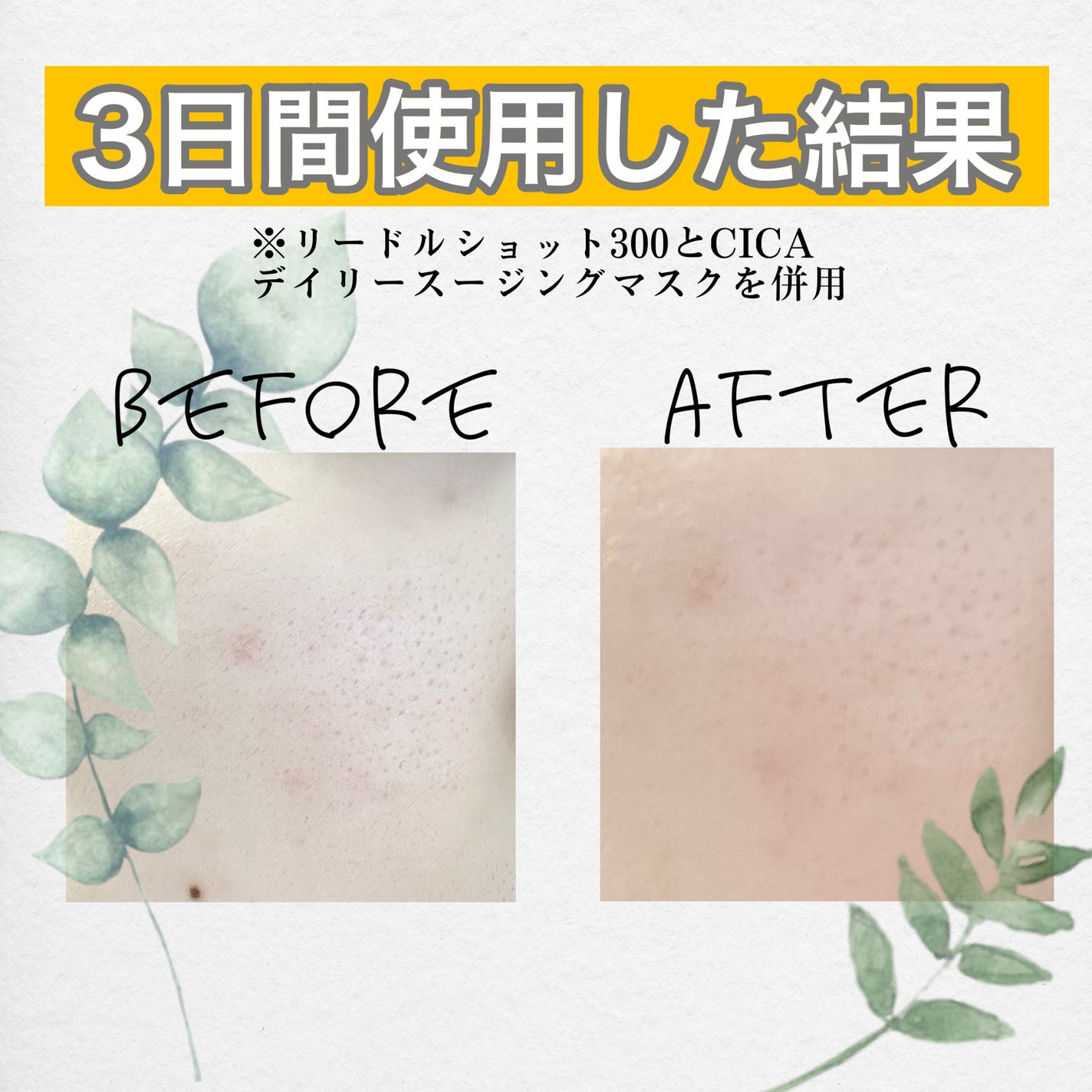 CICA デイリースージングマスク/VT/シートマスク・パックを使ったクチコミ(5枚目)
