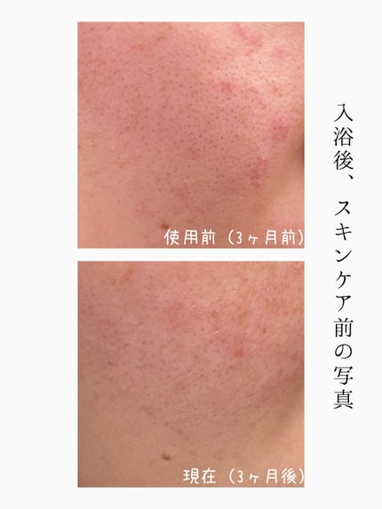 クリアケア化粧水 高保湿タイプ/無印良品/化粧水を使ったクチコミ(4枚目)