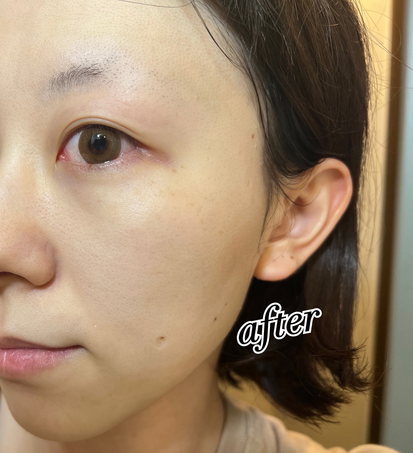 ビタバランスジェルクレンジング/.akaran/クレンジングジェルを使ったクチコミ(7枚目)