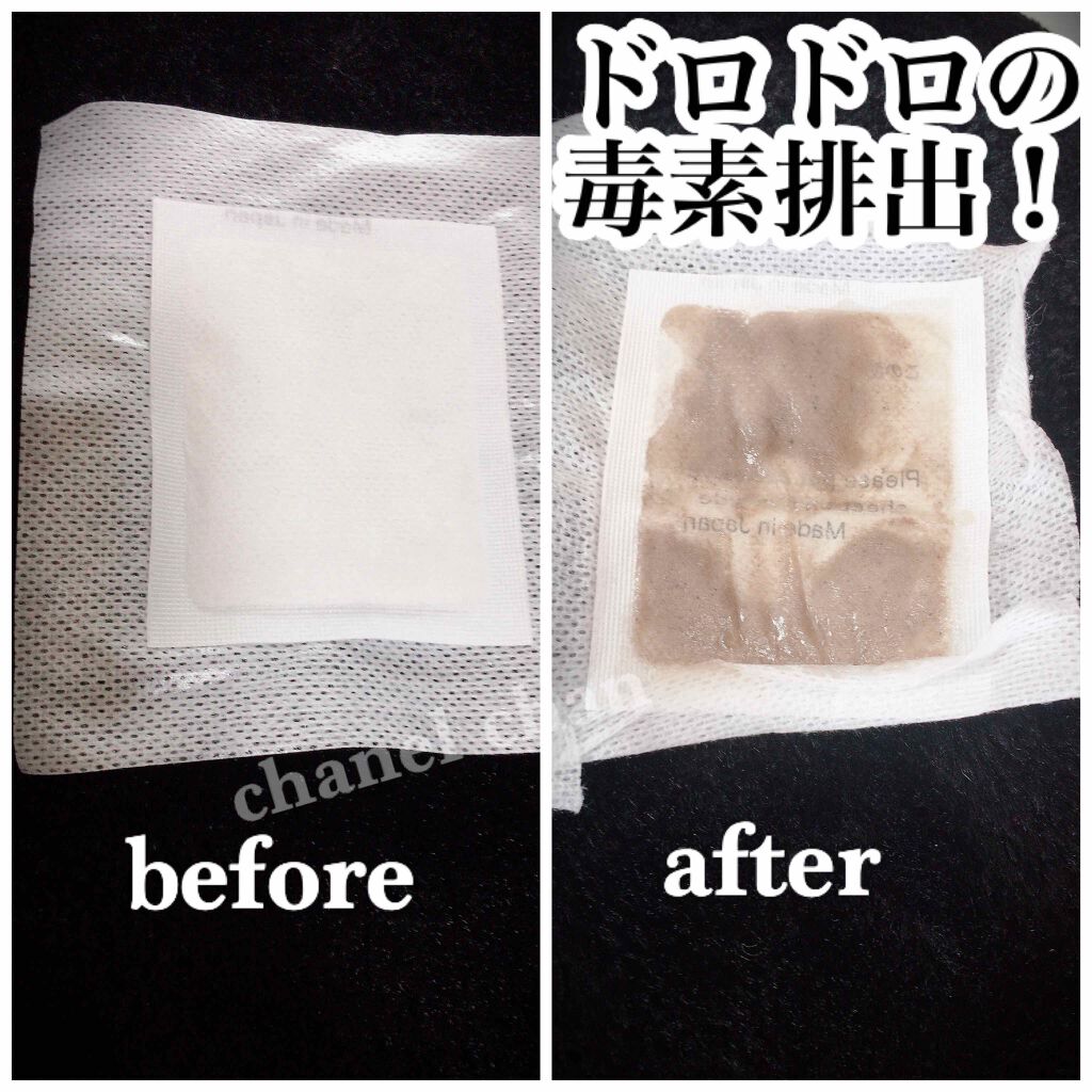 足裏樹液シート/DAISO/レッグ・フットケアを使ったクチコミ（3枚目）