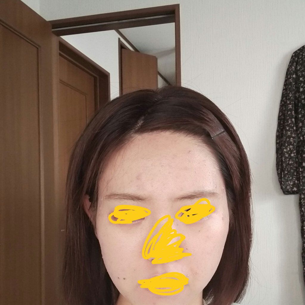 ミノン アミノモイスト モイストチャージ ミルク/ミノン/乳液を使ったクチコミ（1枚目）