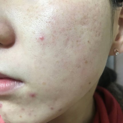 ドクタージャルト シカペア リカバー (第2世代)/Dr.Jart+/フェイスクリームを使ったクチコミ(2枚目)