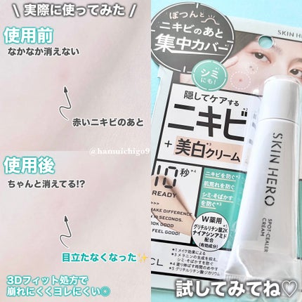 薬用スポットシーラークリーム/スキンヒーロー/クリームコンシーラーを使ったクチコミ(4枚目)