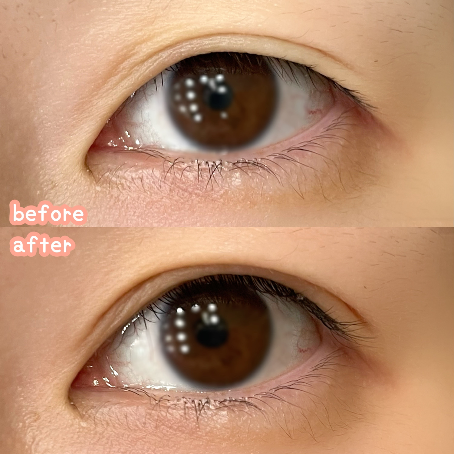 メザイク クリップ カッター ファイバー専用カッター/メザイク/二重まぶた用アイテムを使ったクチコミ（2枚目）