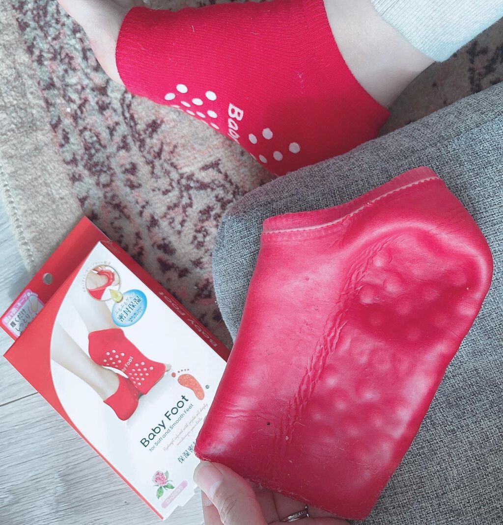 ベビーフット 保湿密封ソックス/ベビーフット/レッグ・フットケアを使ったクチコミ（3枚目）