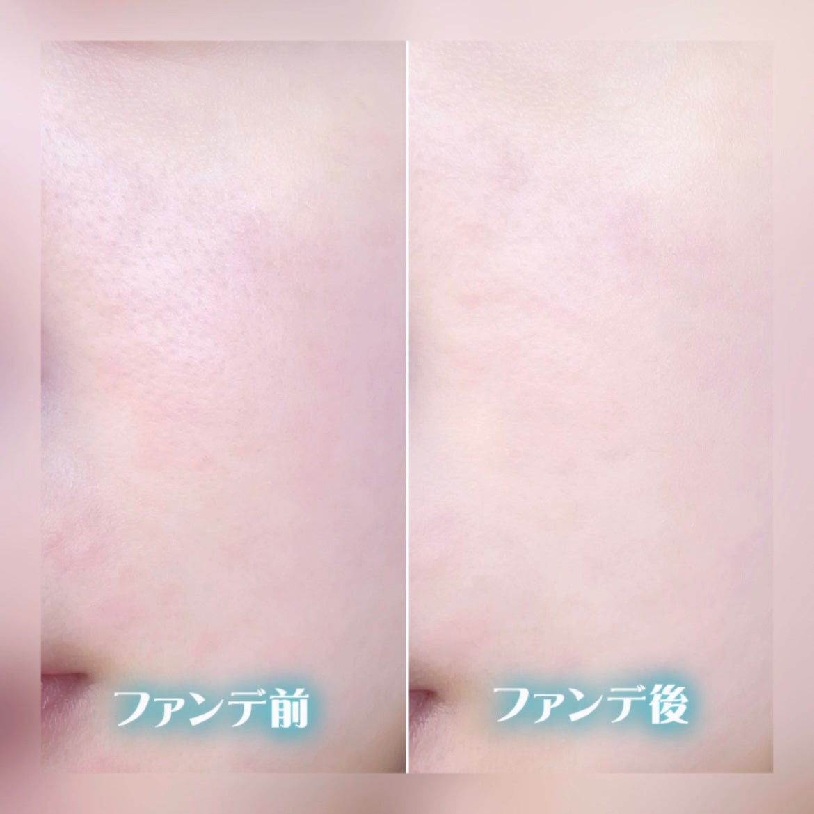 センテラリリーフカバークッション/DR.PEPTI/クッションファンデーションを使ったクチコミ(5枚目)