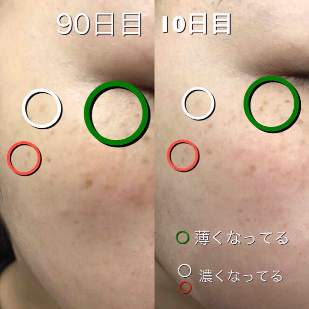 ブライトニングエマルジョン さっぱり/DEW/乳液を使ったクチコミ(3枚目)