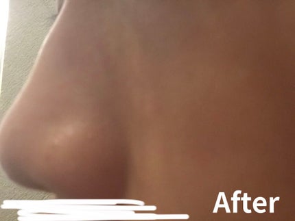 ロゼット 洗顔パスタ 荒性肌/ロゼット/洗顔フォームを使ったクチコミ(5枚目)