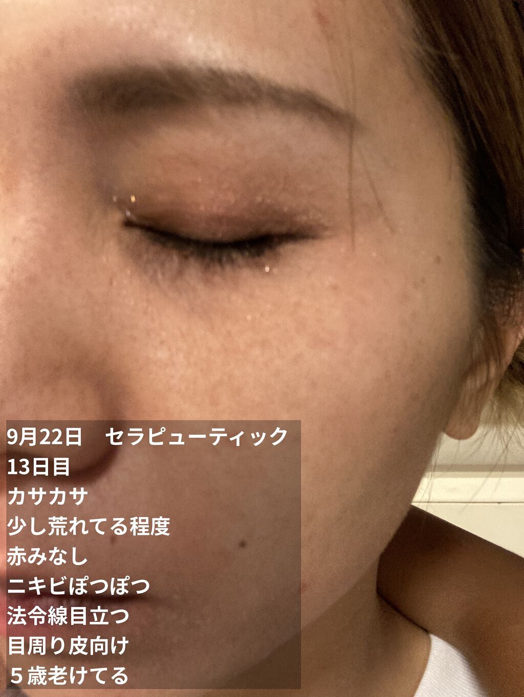 ミラミックス/ZO Skin Health/フェイスクリームを使ったクチコミ（2枚目）