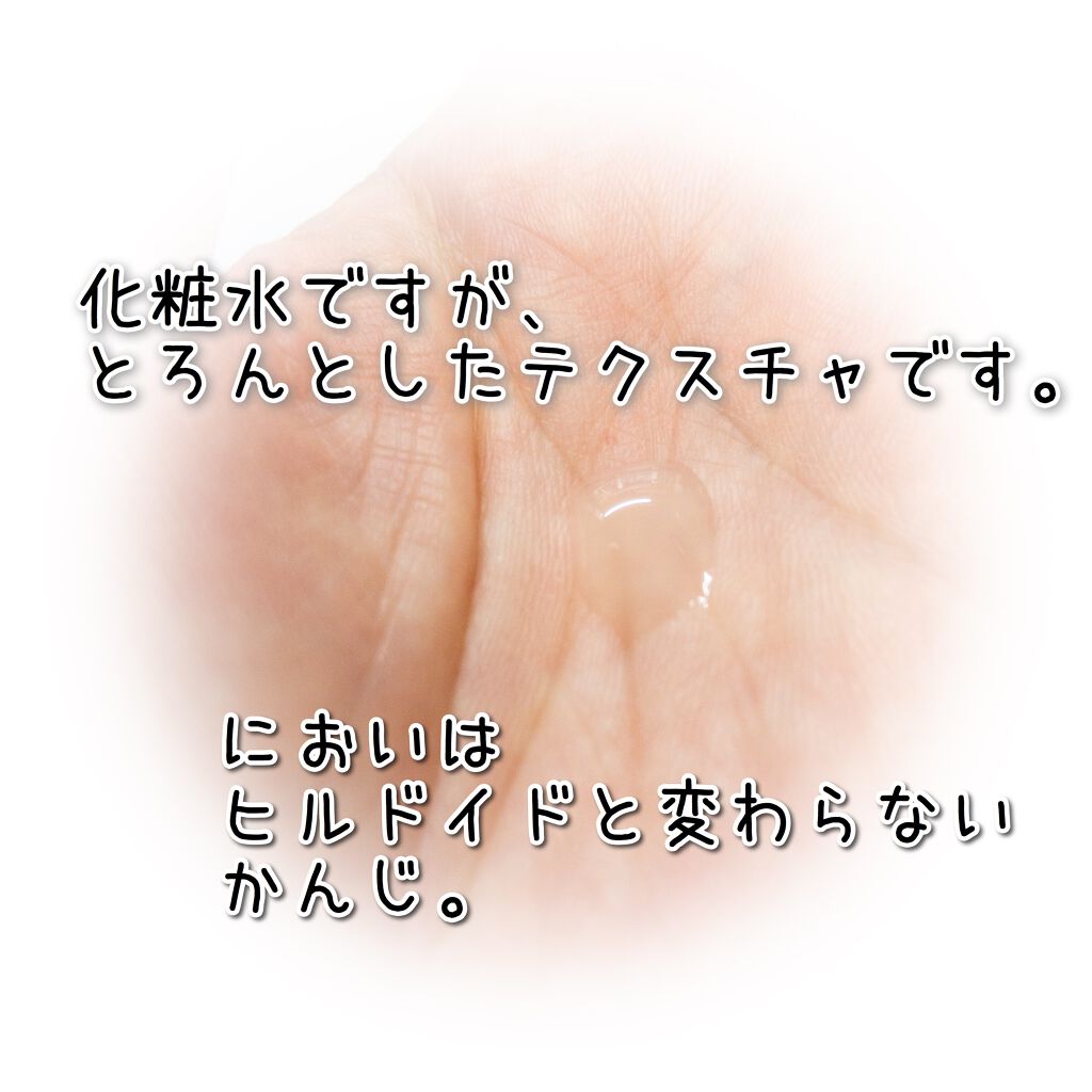 モイスチュア ローション 35ml/カルテHD/化粧水を使ったクチコミ（3枚目）