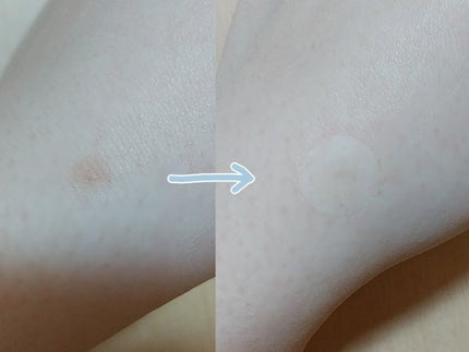 クリアパッチ/Angelab/にきびパッチを使ったクチコミ(2枚目)