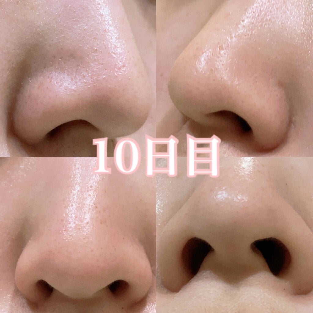 サヴォン ド マルセイユ オリーブ石鹸/ル セライユ/洗顔石鹸を使ったクチコミ(4枚目)