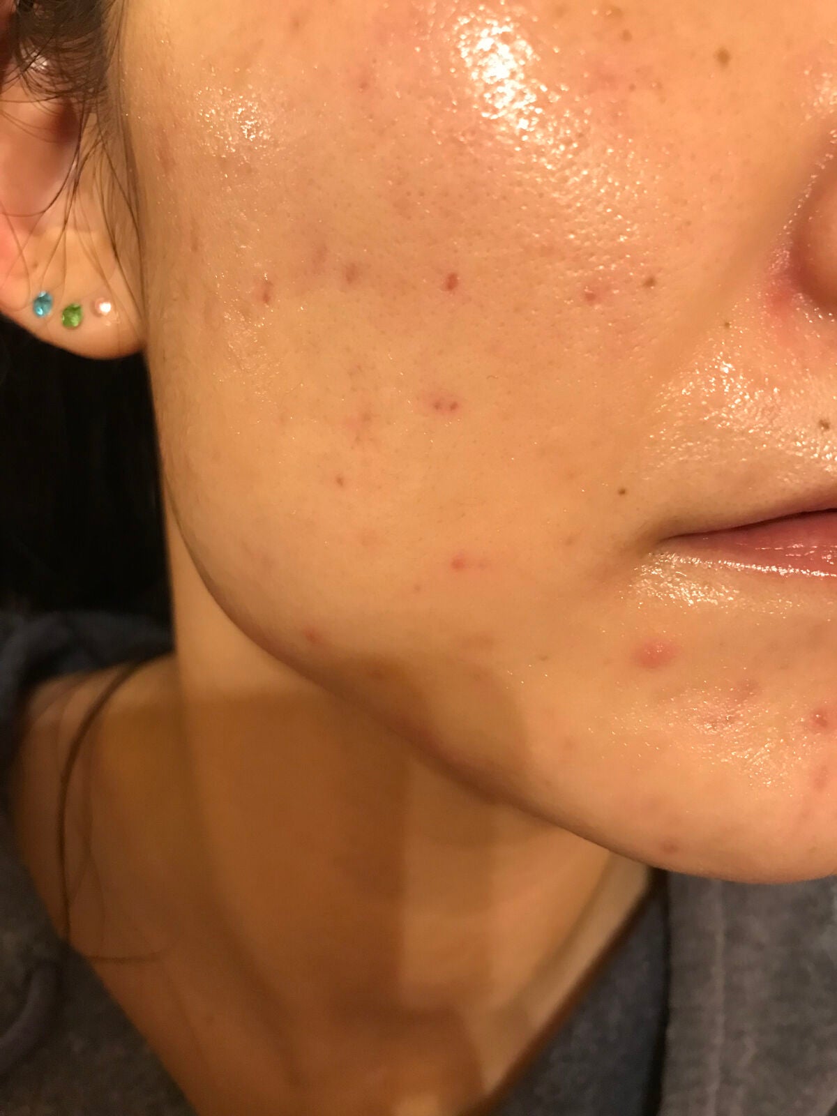 レチノールA 1% アドバンスドリバイタリゼーションクリーム/Life-flo/フェイスクリームを使ったクチコミ(2枚目)