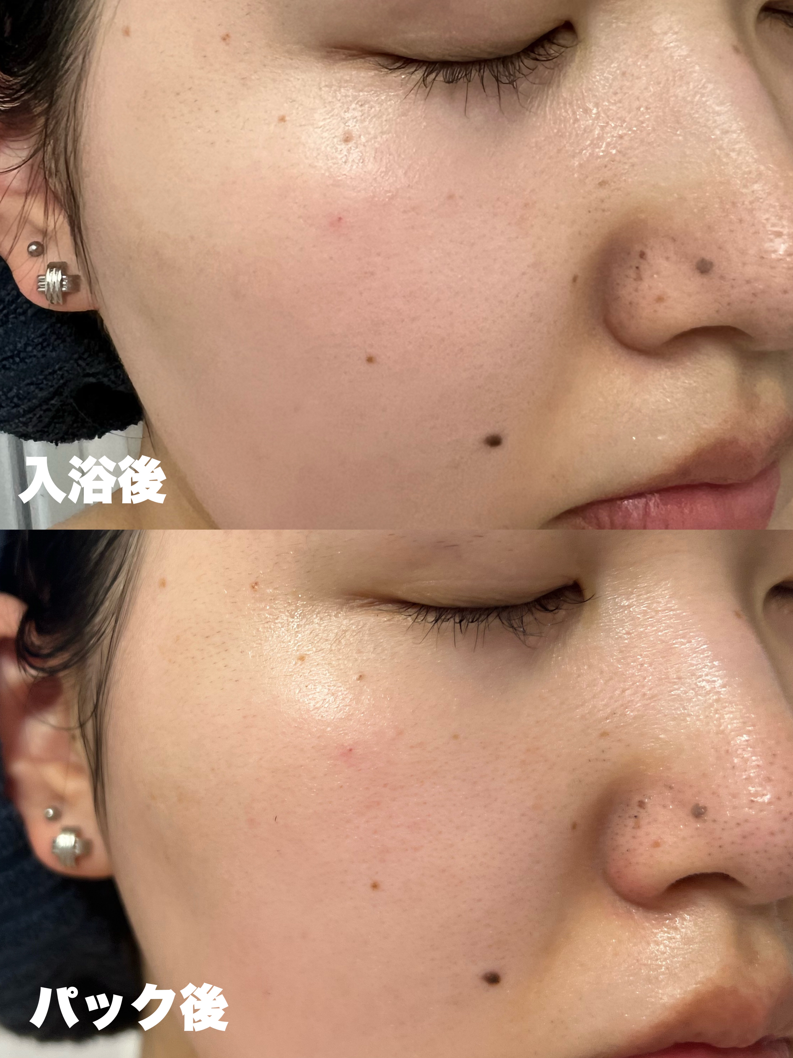 ザ・ダーマ ベストVC100プラスレチノール 5枚/クオリティファースト/シートマスク・パックを使ったクチコミ（3枚目）