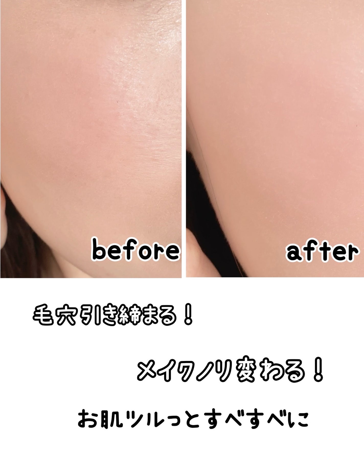 プレミアムもちソープ「グリーンアルティザン」/アレンシア/その他洗顔料を使ったクチコミ(9枚目)