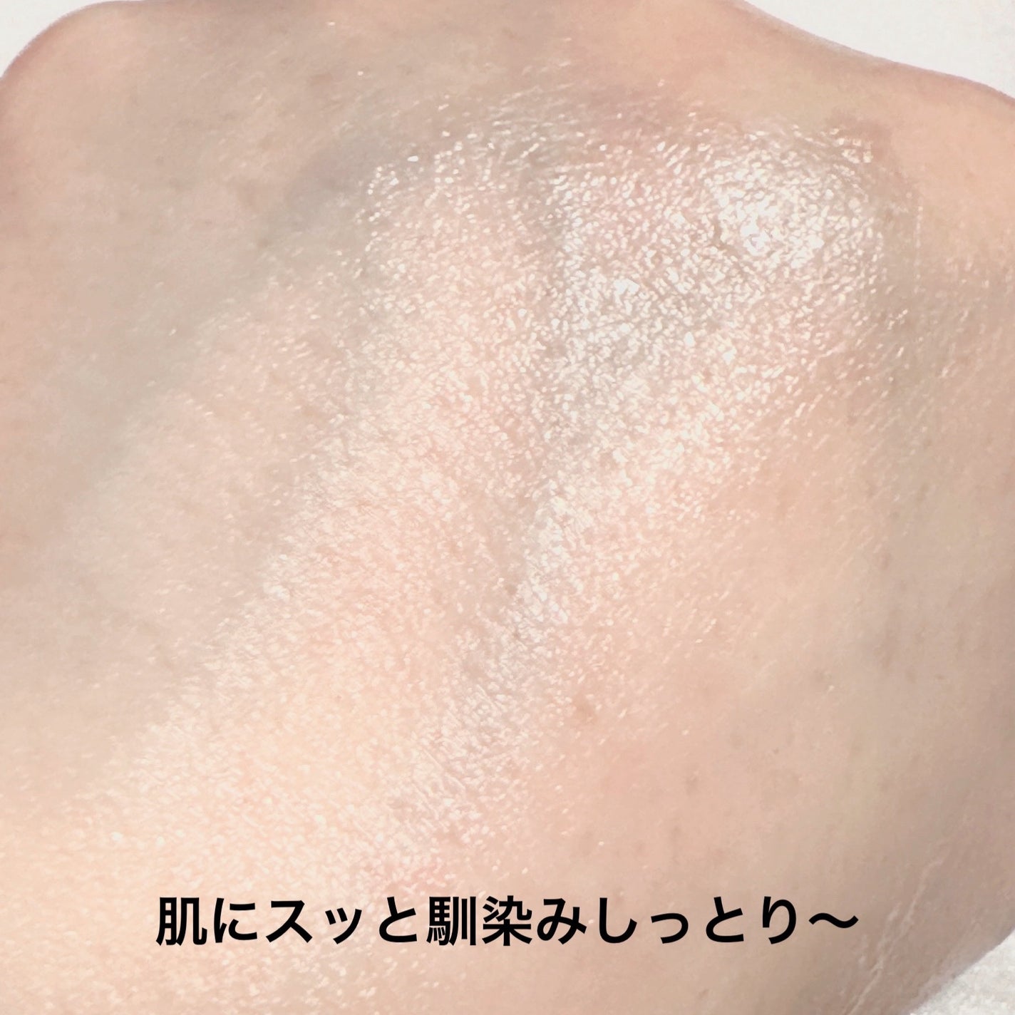 ピンクティーツリートナー/APLIN/化粧水を使ったクチコミ(3枚目)