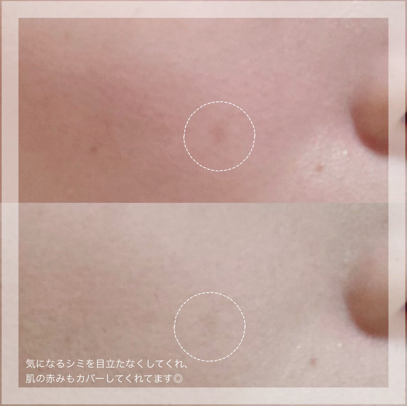 ダーマシンコンシーラー/23years old/リキッドコンシーラーを使ったクチコミ(3枚目)