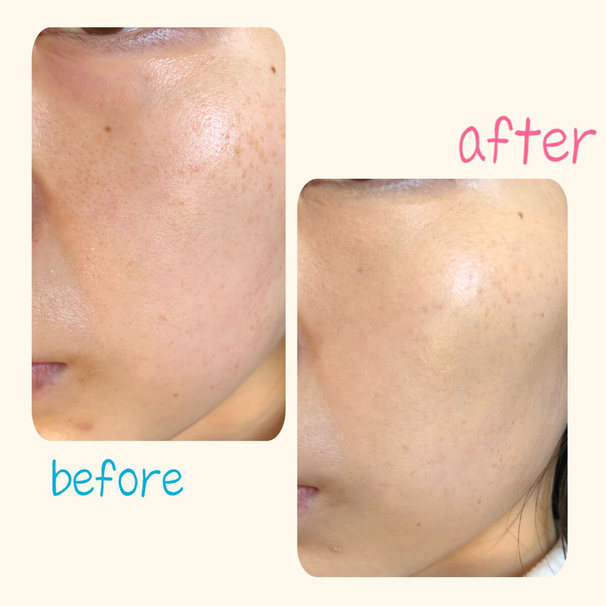 （旧）アンリミテッド ラスティング フルイド/shu uemura/リキッドファンデーションを使ったクチコミ（3枚目）