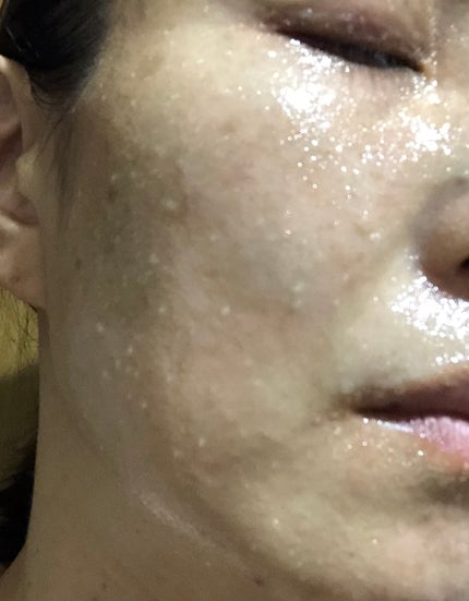 温感ブルーマスク/Torhop/洗い流すパック・マスクを使ったクチコミ(4枚目)