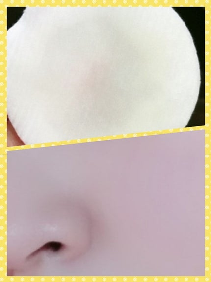 スキンフェイドローションV/デルミサ/化粧水を使ったクチコミ(2枚目)