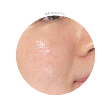 シークレットくすみセラム/Aetem /美容液を使ったクチコミ(5枚目)