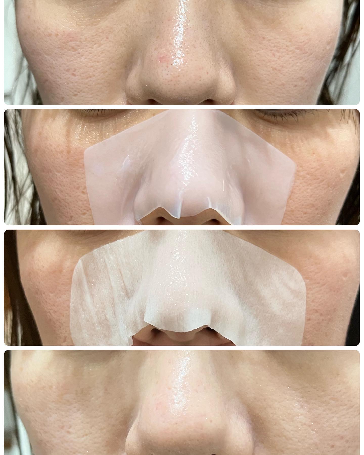 ナチュラルマイルドクリアノーズパック/ilso/シートマスク・パックを使ったクチコミ（2枚目）