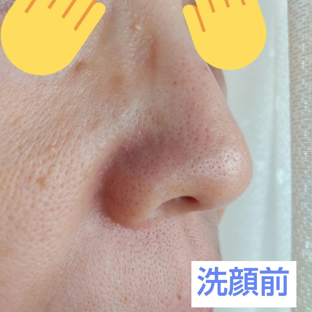 いいじゃんガスール石鹸/イーキューブ/洗顔石鹸を使ったクチコミ(2枚目)