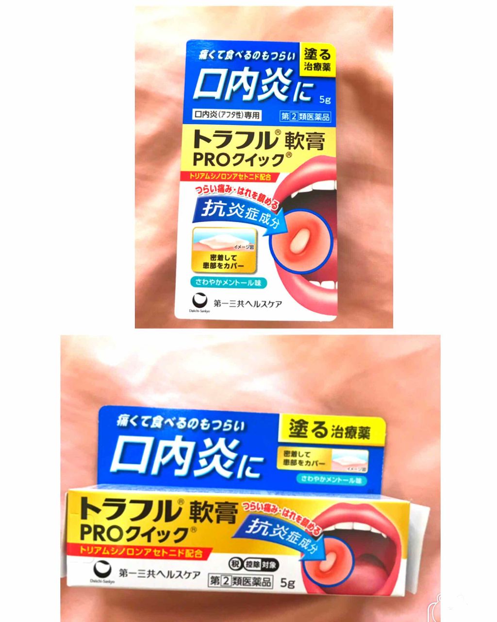 トラフル軟膏ＰＲＯクイック（医薬品）/トラフル/その他を使ったクチコミ（3枚目）