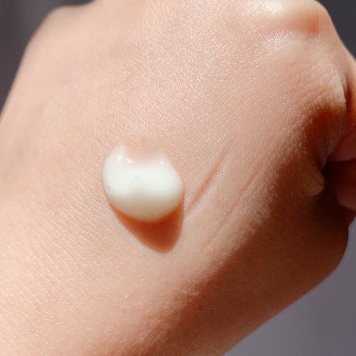 シカレチA エッセンス0.1/VT/美容液を使ったクチコミ（3枚目）