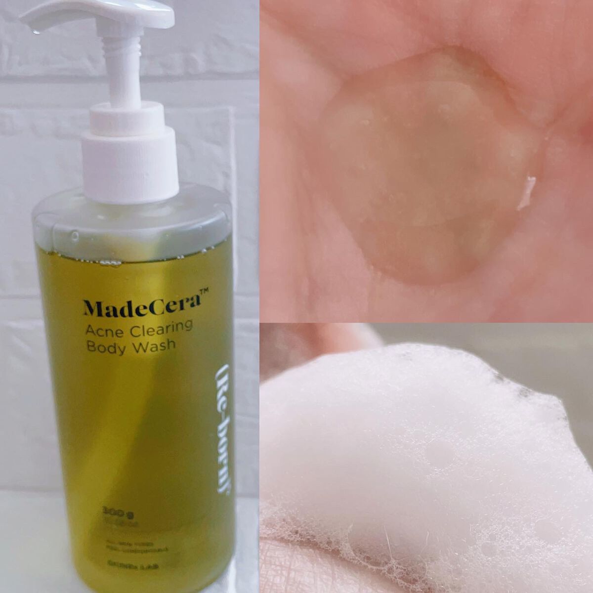 マデセラニキビクリアリングボディウォッシュ/SKINRx LAB/ボディソープを使ったクチコミ(3枚目)