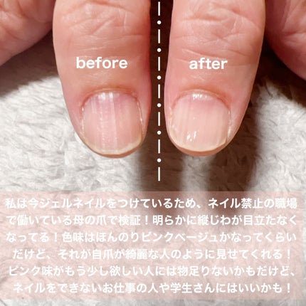 グロスフォーユアネイル/プレビュート/オールインワンネイルを使ったクチコミ(4枚目)