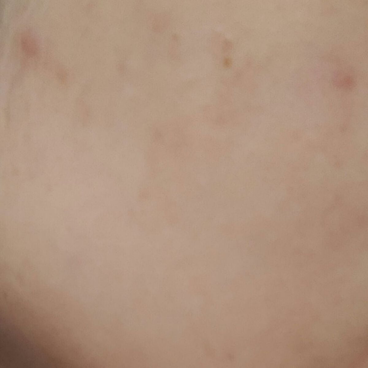 白潤 薬用美白化粧水(しっとりタイプ)/肌ラボ/化粧水を使ったクチコミ(3枚目)