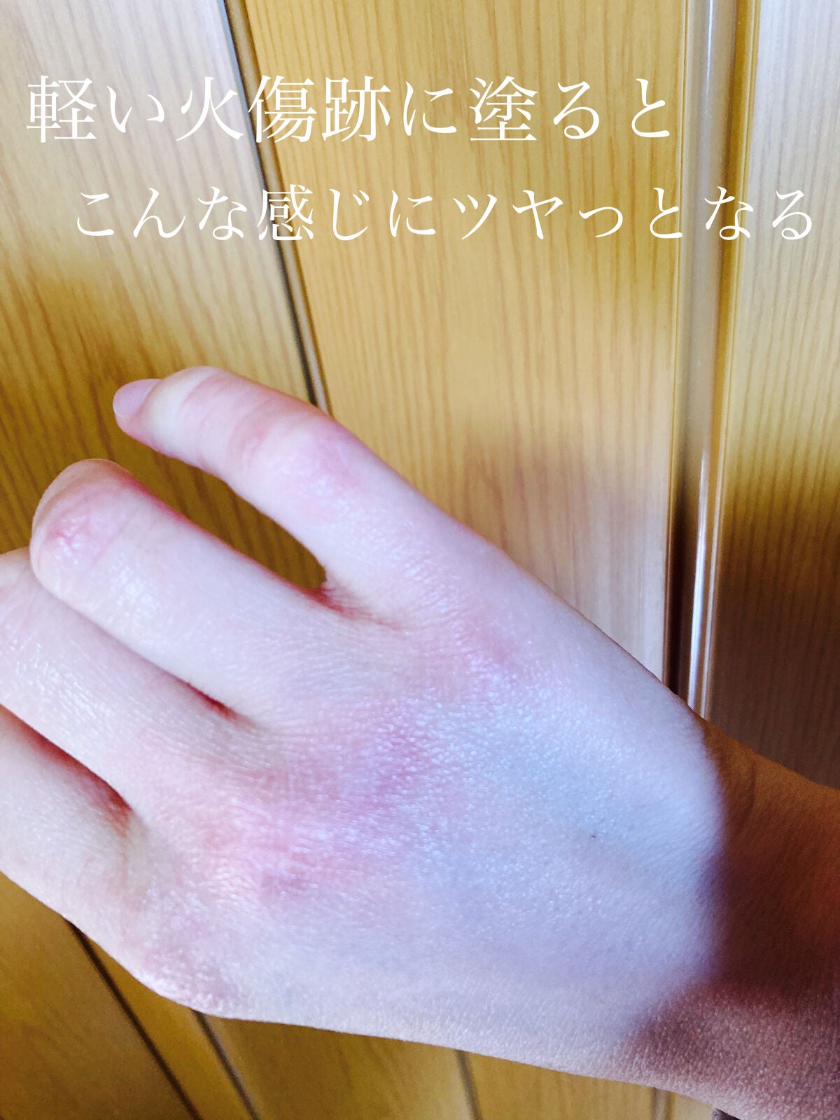 キップパイロール-Hi(医薬品)/佐藤製薬/その他を使ったクチコミ(4枚目)